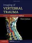Imaging of Vertebral Trauma Imaging of Vertebral Trauma