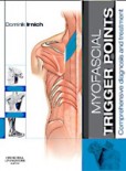 Myofascial Trigger Points