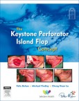 The Keystone Island Flap Concept in Reconstructive Surgery