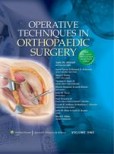 Operative Techniques in Orthopaedic Surgery Operative Techniques in Orthopaedic Surgery