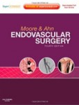 Endovascular Surgery Endovascular Surgery