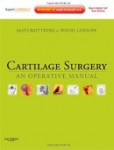 Cartilage Surgery Cartilage Surgery