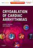 Cryoablation of Cardiac Arrhythmias Cryoablation of Cardiac Arrhythmias