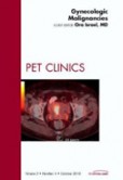 Gynecologic Malignancies