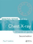 Making Sense Chest X-Ray Making Sense Chest X-Ray