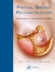 Partial Breast Reconstruction: Techniques in Oncoplastic Surgery, 2nd Edition