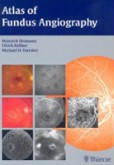 Atlas of Fundus Angiography Atlas of Fundus Angiography