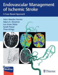 Endovascular Management of Ischemic Stroke Endovascular Management of Ischemic Stroke