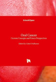 Oral Cancer Oral Cancer