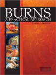 Burns - A Practical Approach