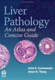 Liver Pathology Liver Pathology