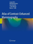 Atlas of Contrast-Enhanced Mammography Atlas of Contrast-Enhanced Mammography