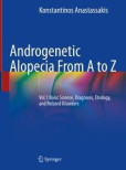 Androgenetic Alopecia From A to Z Androgenetic Alopecia From A to Z