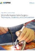Minimally Invasive Spine Surgery Minimally Invasive Spine Surgery