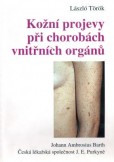 Kožní projevy při chorobách vnitřních orgánů Kožní projevy při chorobách vnitřních orgánů