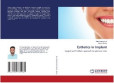 Esthetics in Implant Esthetics in Implant