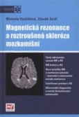 Magnetická rezonance a roztroušená skleróza mozkomíšní Magnetická rezonance a roztroušená skleróza mozkomíšní