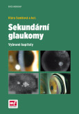 Sekundární glaukomy Sekundární glaukomy