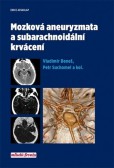 Mozková aneurysmata a subarachnoidální krvácení Mozková aneurysmata a subarachnoidální krvácení