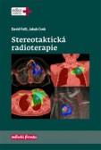 Stereotaktická radioterapie Stereotaktická radioterapie