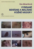 Vybrané benígne a malígne kožné nádory Vybrané benígne a malígne kožné nádory