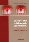 Plastická chirurgie parodontu