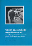 Vyšetření ramenního kloubu magnetickou rezonancí s podrobným Vyšetření ramenního kloubu magnetickou rezonancí s podrobným