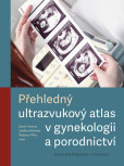 Přehledný ultrazvukový atlas v gynekologii a porodnictví Přehledný ultrazvukový atlas v gynekologii a porodnictví