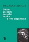 Difuzní axonální poranění mozku a jeho diagnostika Difuzní axonální poranění mozku a jeho diagnostika