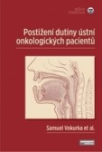 Postižení dutiny ústní onkologických pacientů