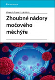 Zhoubné nádory močového měchýře Zhoubné nádory močového měchýře