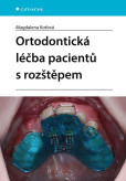 Ortodontická léčba pacientů s rozštěpem Ortodontická léčba pacientů s rozštěpem