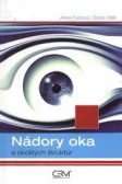 Nádory oka a okolitých štruktúr Nádory oka a okolitých štruktúr