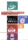 Ultrazvukové vyšetření mozku přes velkou fontanelu Ultrazvukové vyšetření mozku přes velkou fontanelu