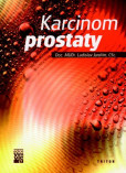 Karcinom prostaty Karcinom prostaty