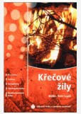 Křečové žíly Křečové žíly