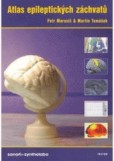 Atlas epileptických záchvatů +cd priručka Atlas epileptických záchvatů +cd priručka