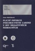 Plicní infekce Pneumocystis carinii u HIV negativních nemocných Plicní infekce Pneumocystis carinii u HIV negativních nemocných