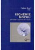 Ischémie mozku