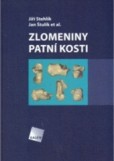 Zlomeniny patní kosti Zlomeniny patní kosti