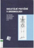 Skeletální postižení v uroonkologii
