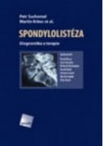 Spondylolistéza Spondylolistéza