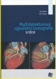 Multidetektorová výpočetní tomografie srdce