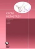 Krční metastázy Krční metastázy