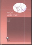 Krční metastázy Krční metastázy