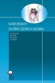 Karcinomy dutiny ústní a hltanu Karcinomy dutiny ústní a hltanu