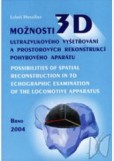Možnosti 3D ultrazvukového vyšetřování a prostorových rekonstrukcí pohybového aparátu  