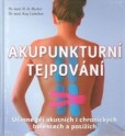 Akupunkturní tejpování Akupunkturní tejpování