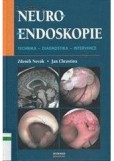 Neuroendoskopie Neuroendoskopie