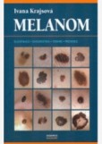 Melanom Melanom